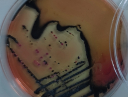 Microbial contamination control in food factories
