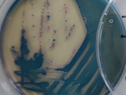Microbial contamination control in feed mills